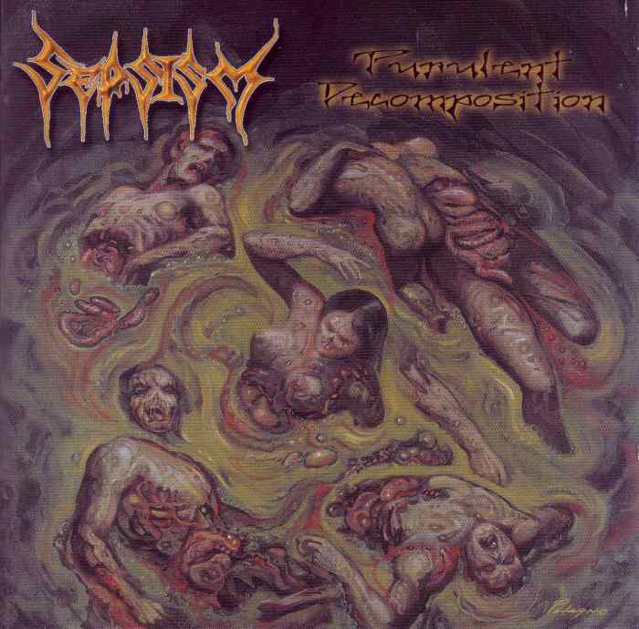 sepsism – purulent decomposition